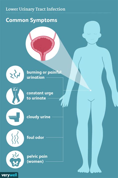 female urination standing|Urinary Tract Infection (UTI): Symptoms, Diagnosis .